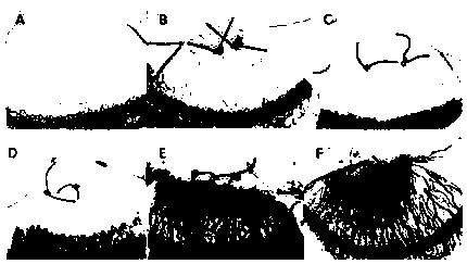 Application of bone morphogenetic protein-4 in drug for treating keratonosus