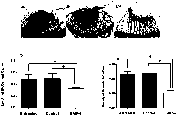 Application of bone morphogenetic protein-4 in drug for treating keratonosus