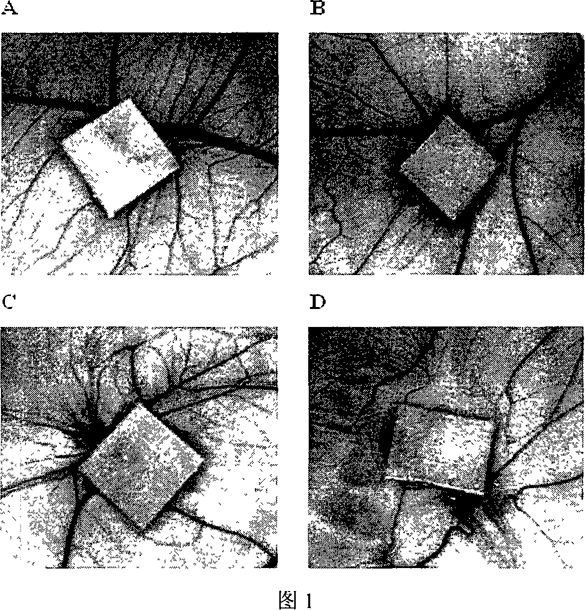 Application of gambogicacid in preparing medication for restraining angiogenesis