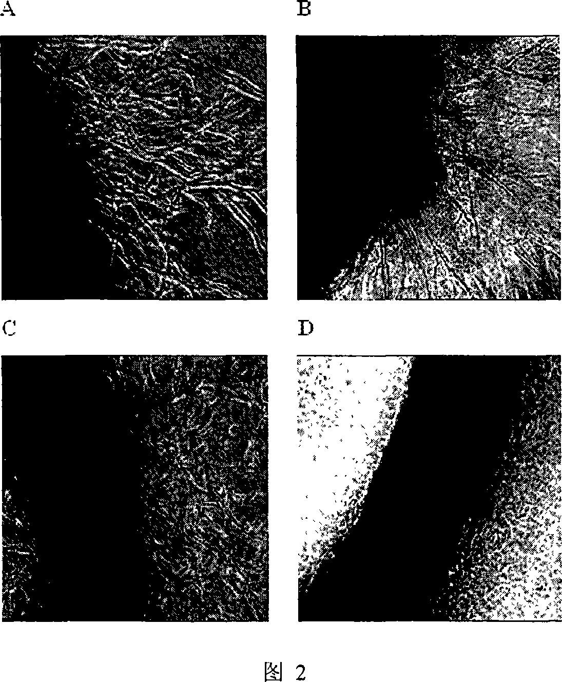 Application of gambogicacid in preparing medication for restraining angiogenesis