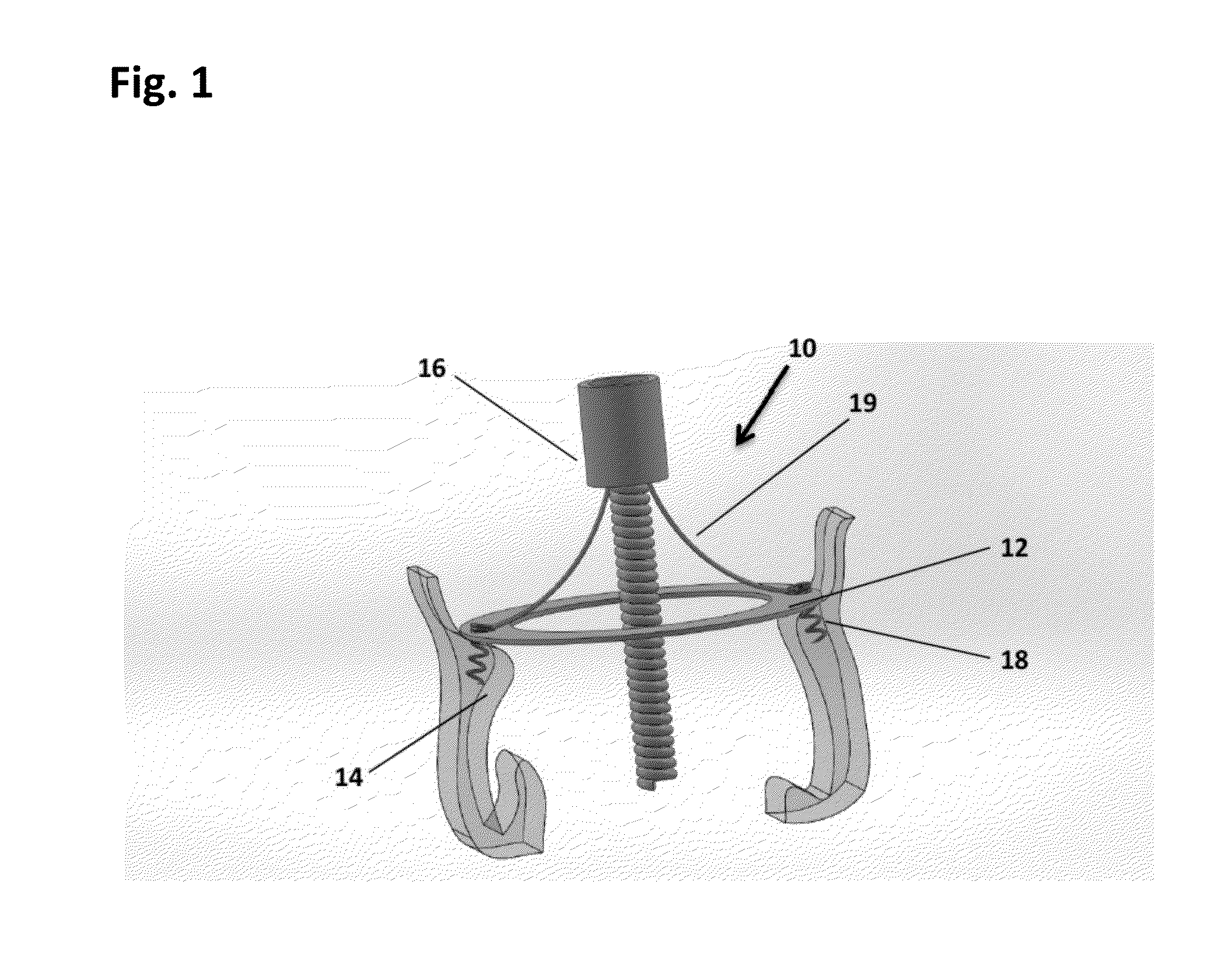 Single-ring cardiac valve support