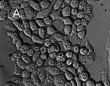 Method for preparing medicament-nanometer calcium phosphate composite system taking fat soluble photosensitizer as framework and application of system in preparation of medicaments for photodynamic therapy