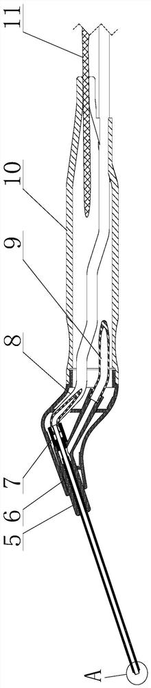 Radio frequency melting electrode for otitis media minimally invasive surgery and using method of radio frequency melting electrode