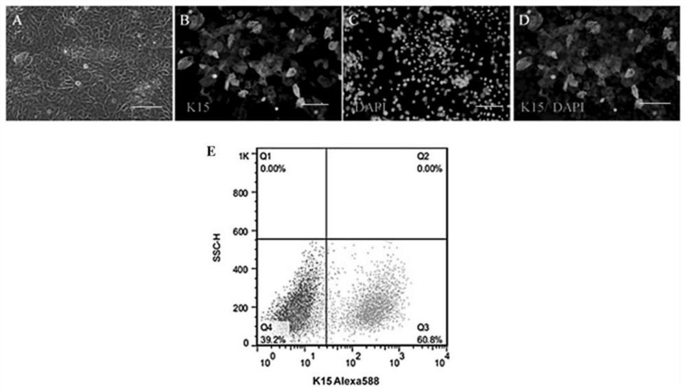 Method for promoting dermal papilla cells to induce hair regeneration through HHORSCs exosome