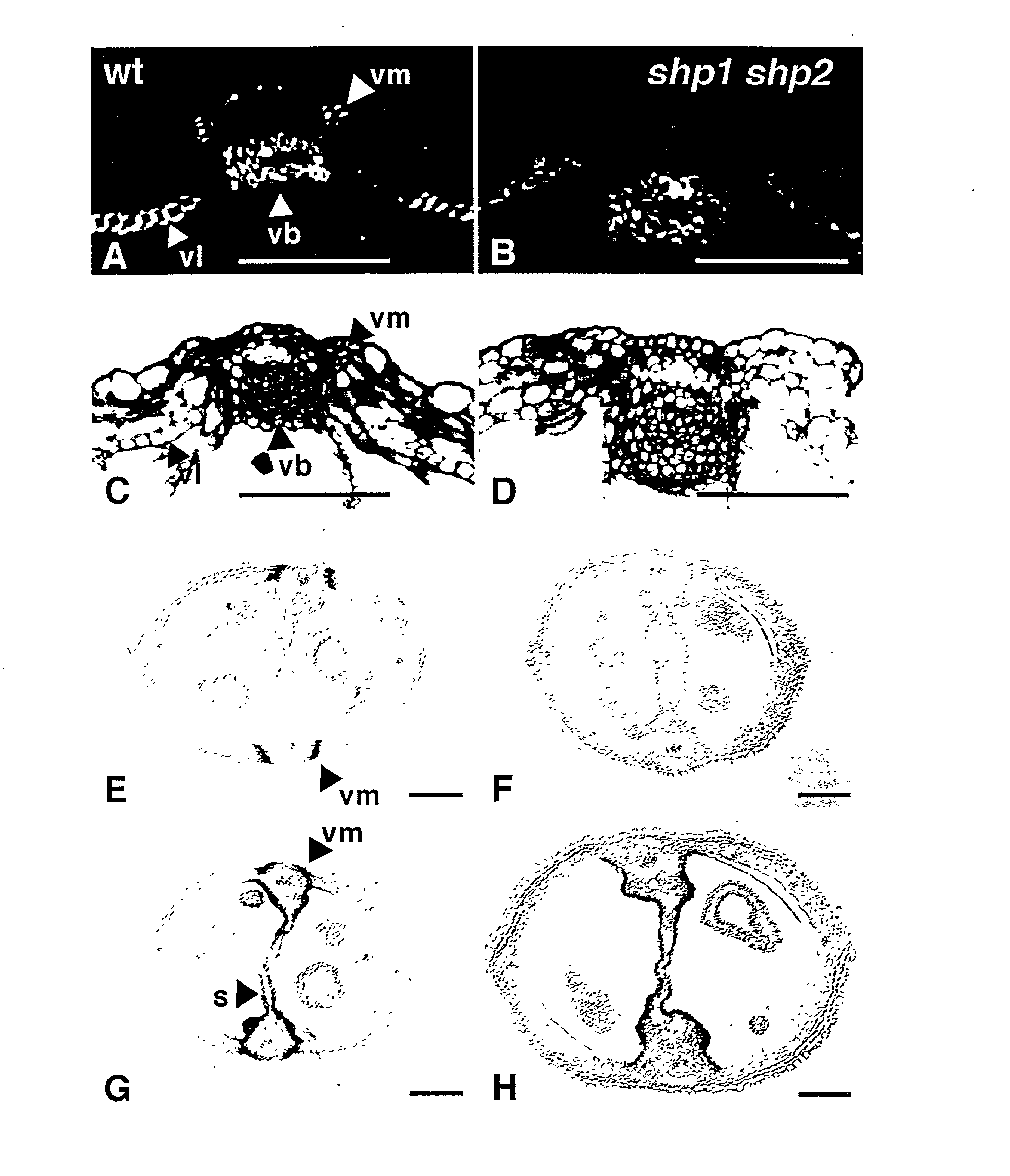 Selective control of lignin biosynthesis in transgenic plants