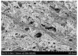 Method for preparing mineral collagen coating on surface of medical implantation body