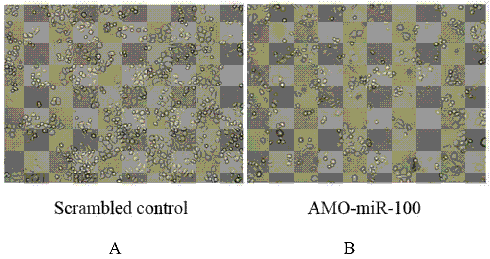 Application of miR-100 inhibitor in preparation of medicine for treating breast cancer