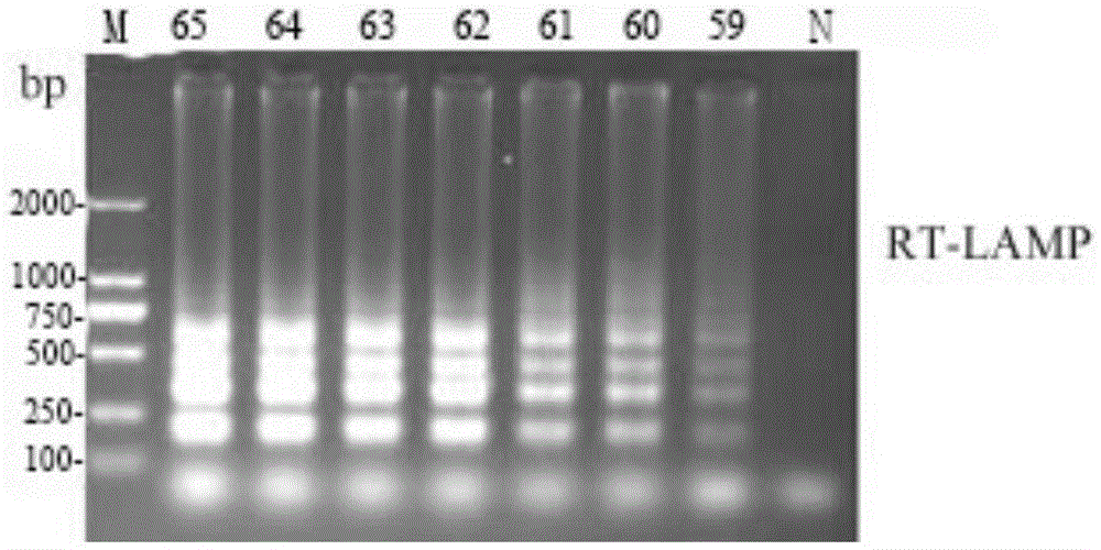 Detection primer set for reverse transcription loop-mediated isothermal amplification of Noroviruses, detection method and kit