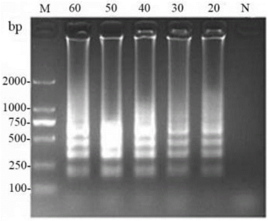 Detection primer set for reverse transcription loop-mediated isothermal amplification of Noroviruses, detection method and kit