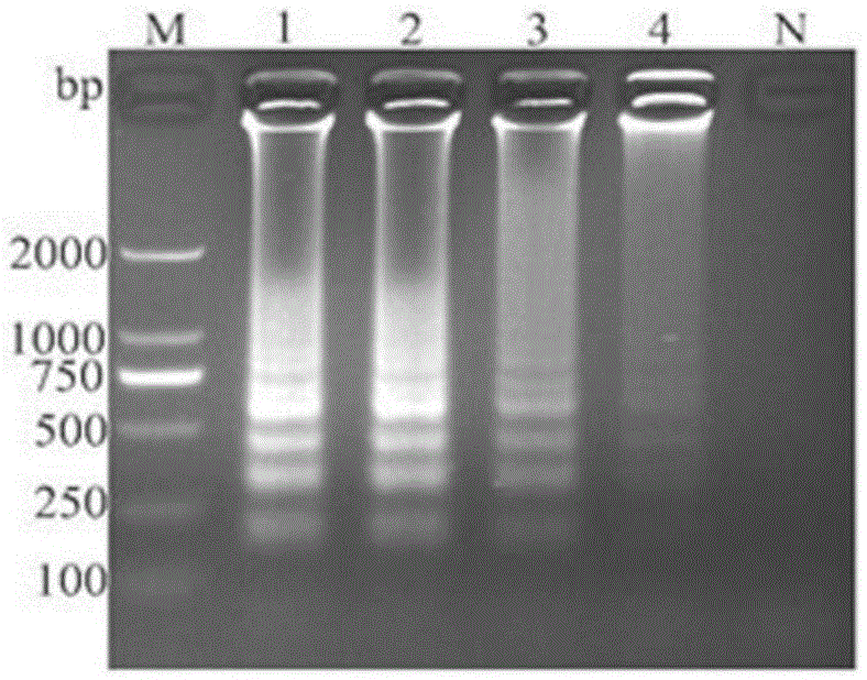 Detection primer set for reverse transcription loop-mediated isothermal amplification of Noroviruses, detection method and kit