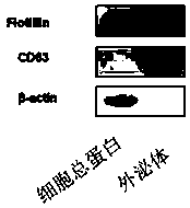 Application of exosome in preparation of anti-infective drugs