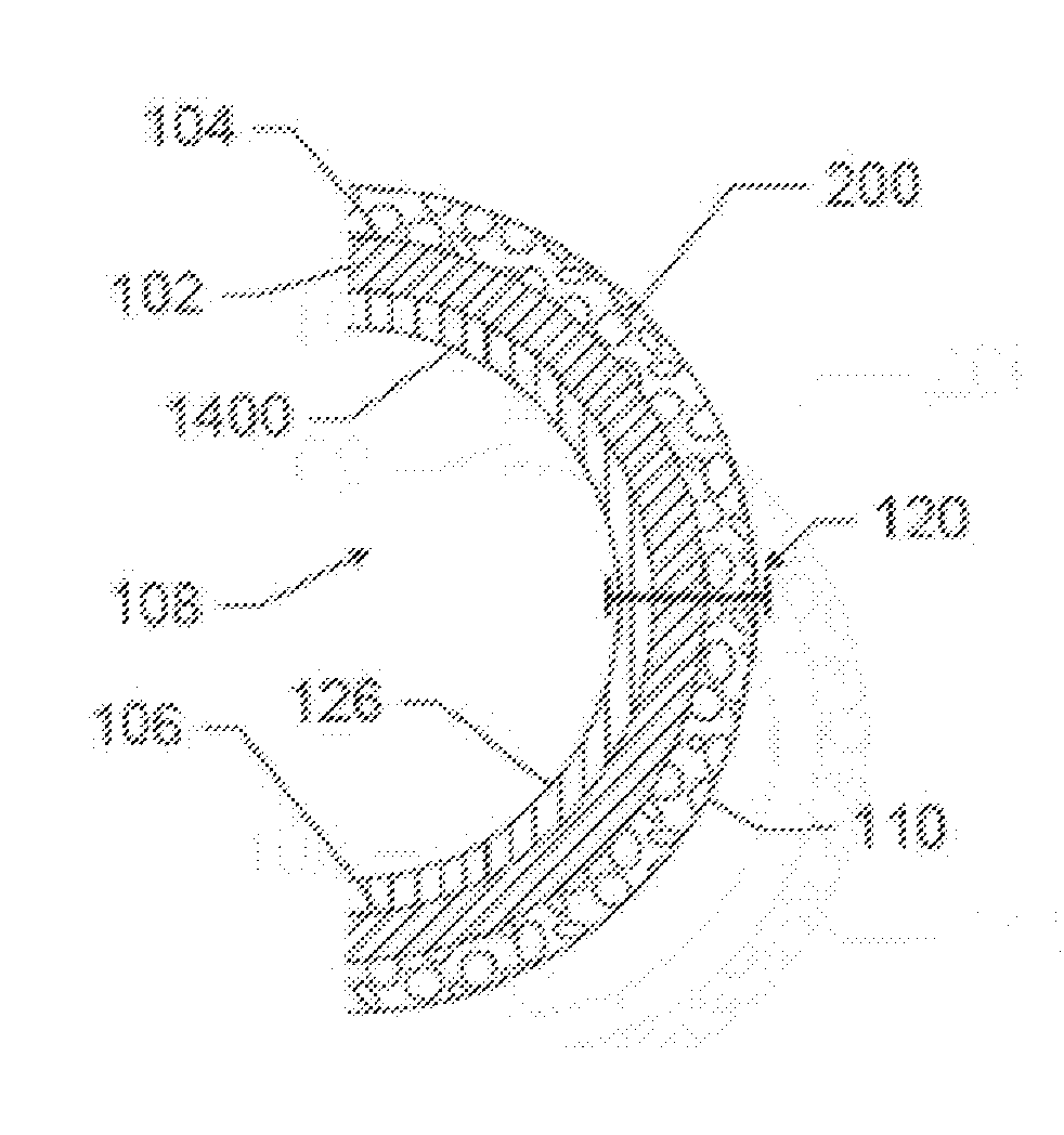 Detachable metal balloon delivery device and method