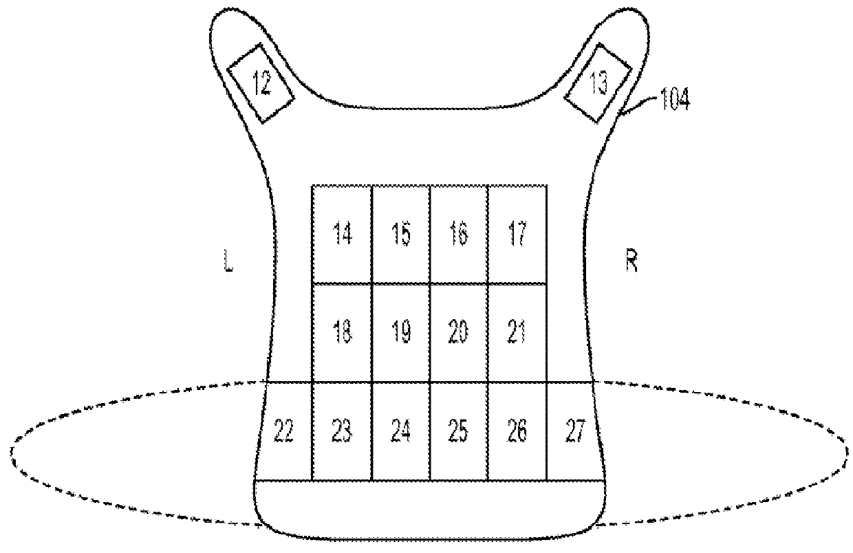 A method and apparatus for mediating proprioceptive skin and body sensors, vision, vestibular and somato-sensation acting in combination with brain function or neurosensory-motor system function