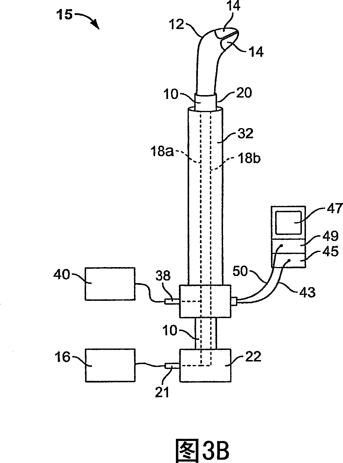 Method and system for transcervical tubal occlusion