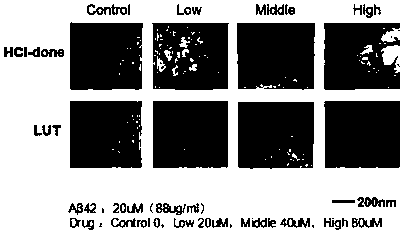 Application of compound in reducing protein accumulation for treating Alzheimer's Disease