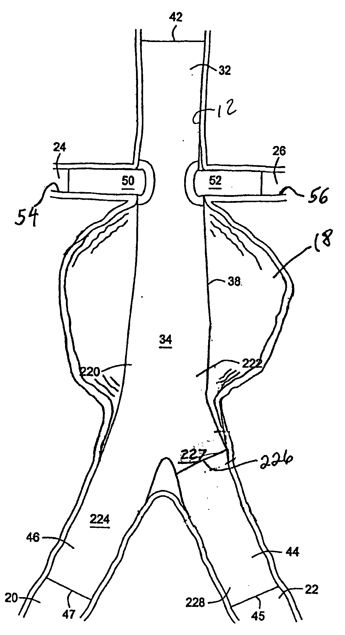 Methods and apparatus for treatment of aneurysms adjacent branch arteries including branch artery flow lumen alignment