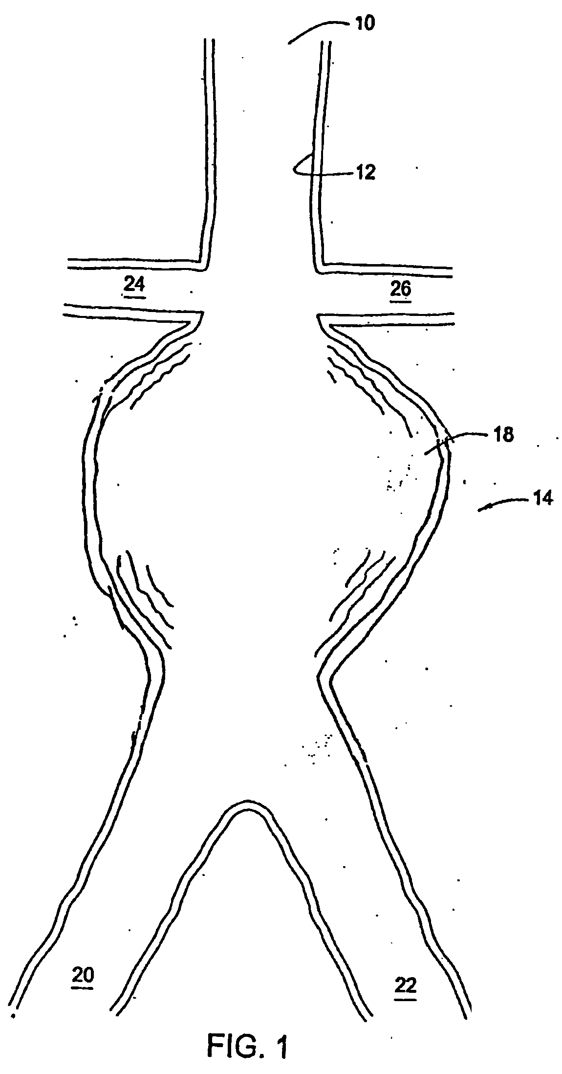 Methods and apparatus for treatment of aneurysms adjacent branch arteries including branch artery flow lumen alignment