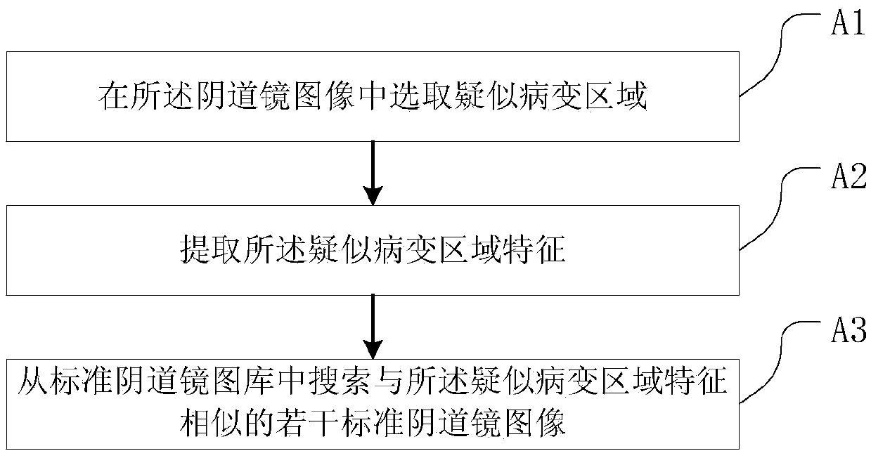 Intelligent identification method and device of colposcope images