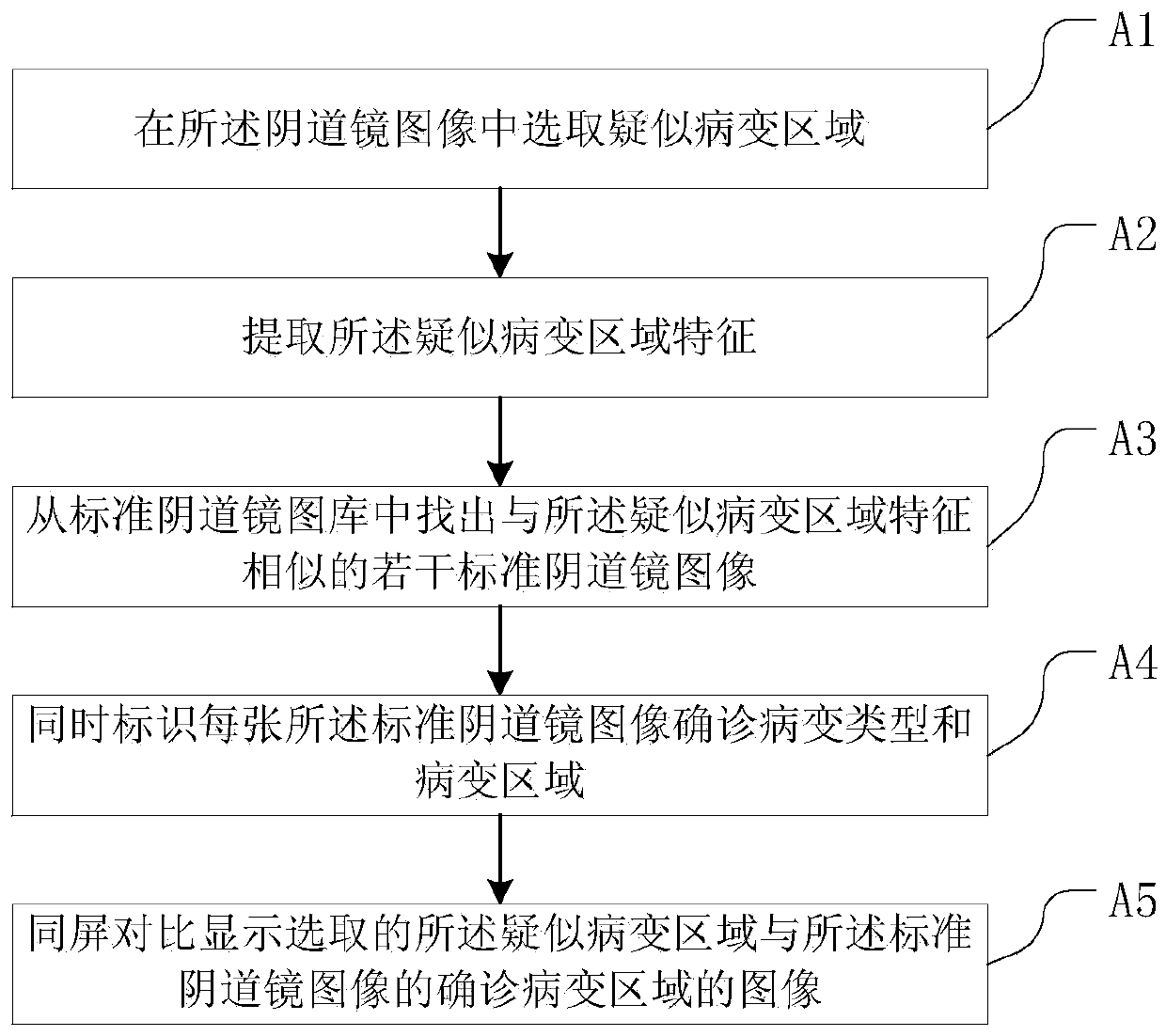 Intelligent identification method and device of colposcope images