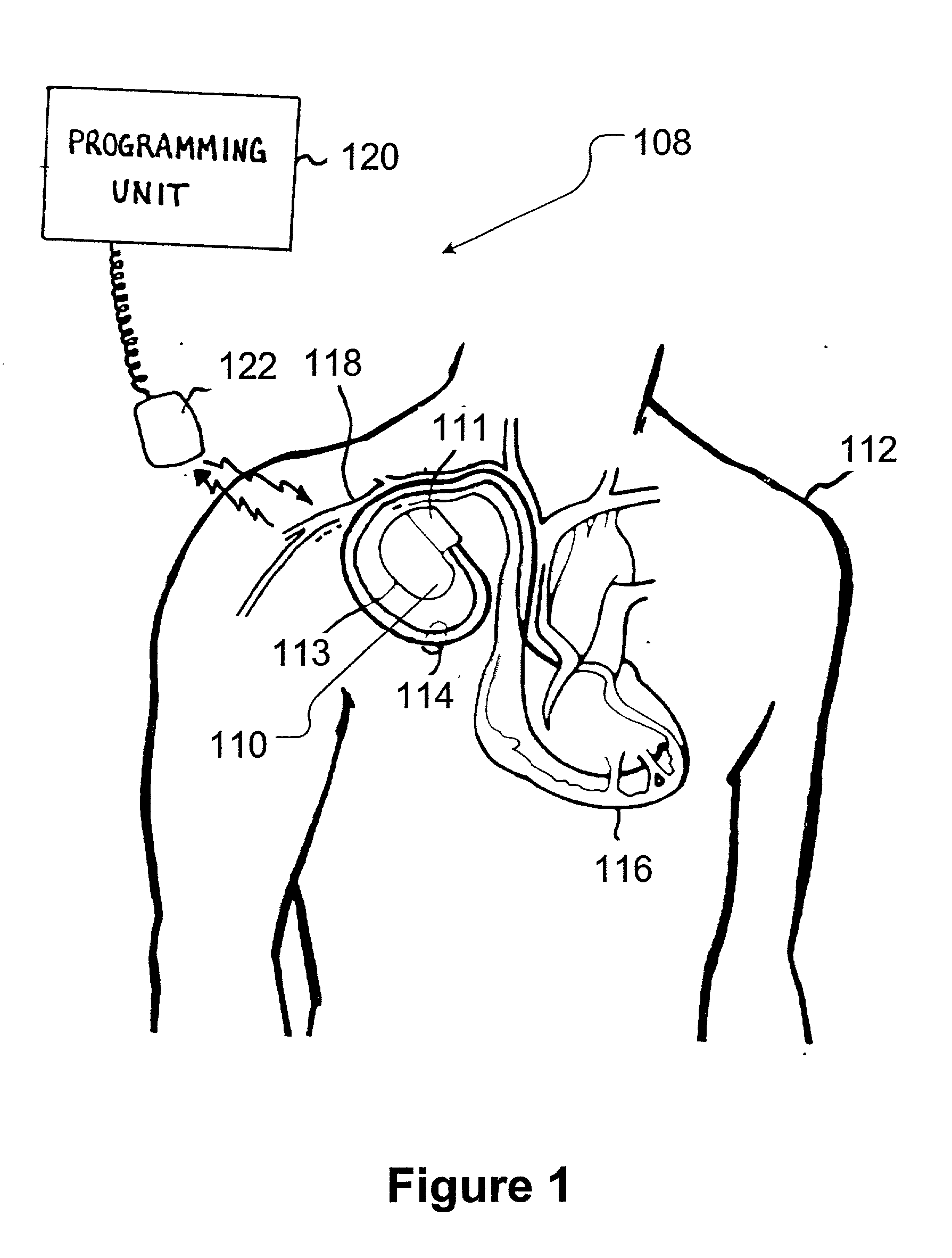 Alternative sensing method for implantable medical device in magnetic resonance imaging device