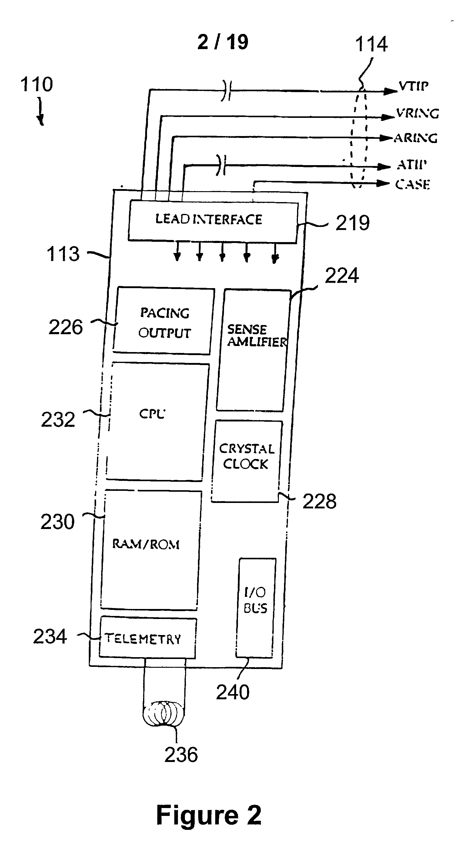 Alternative sensing method for implantable medical device in magnetic resonance imaging device