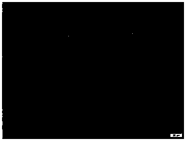 Kit for detecting albumen and application thereof