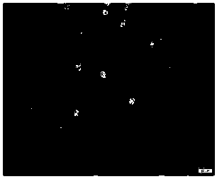 Kit for detecting albumen and application thereof