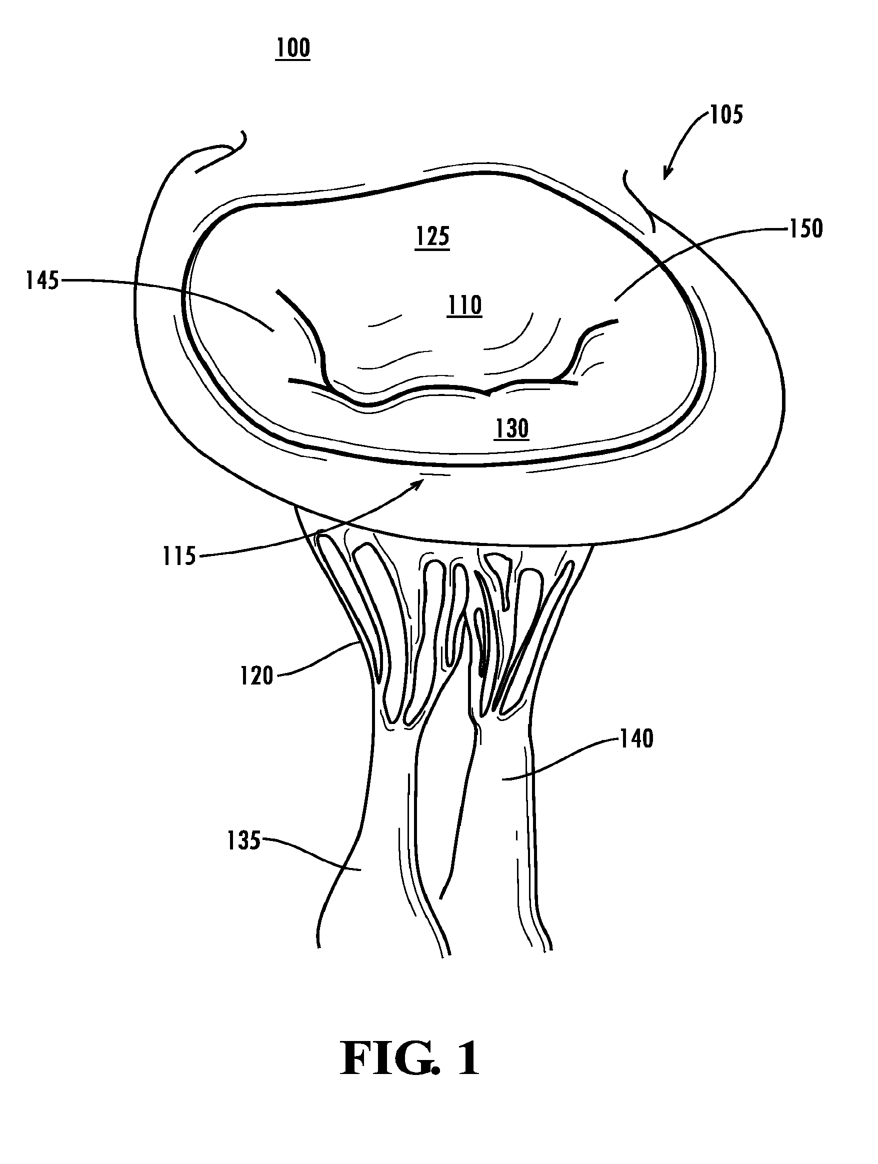 Papillary muscle position control devices, systems, & methods