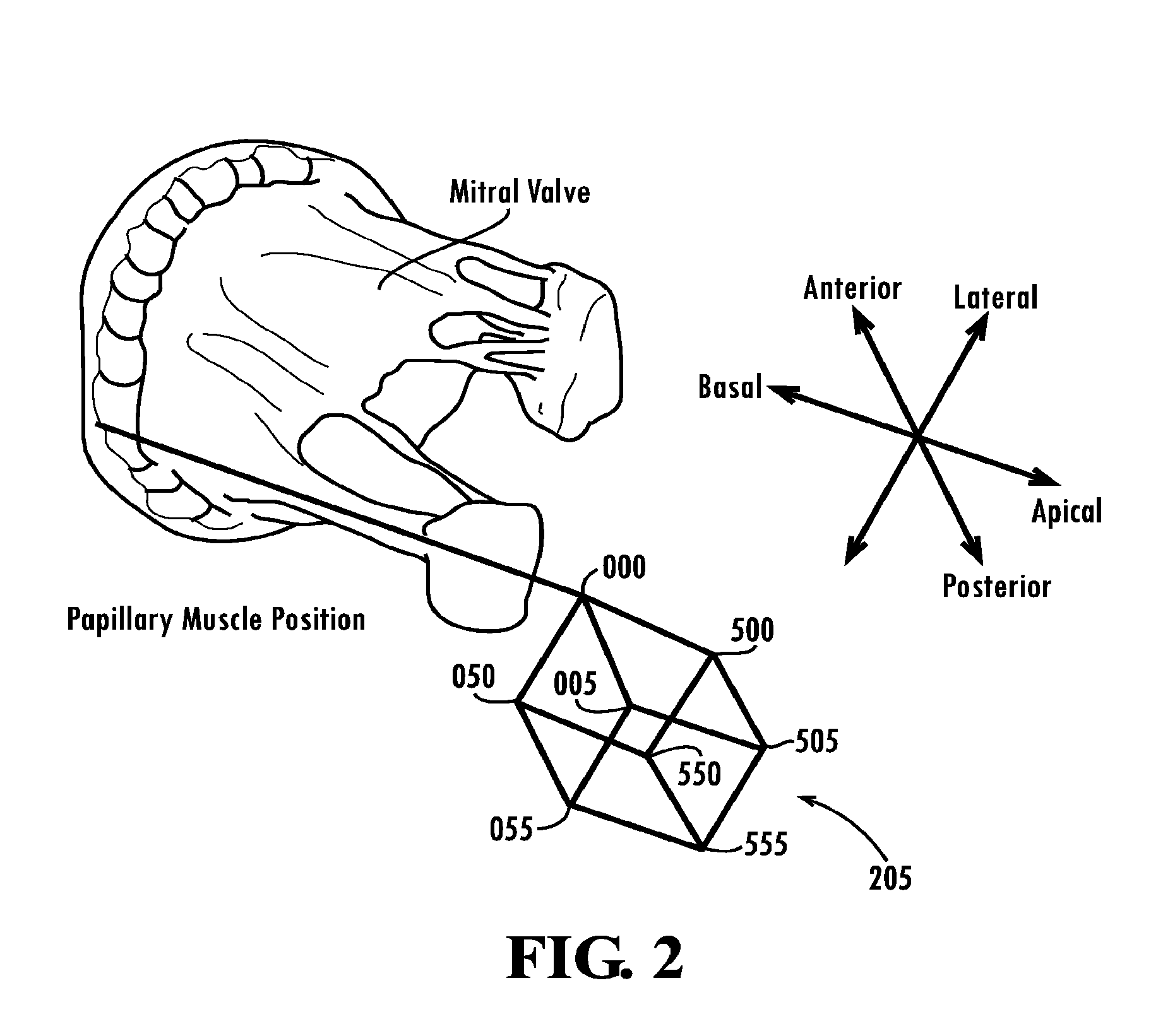 Papillary muscle position control devices, systems, & methods