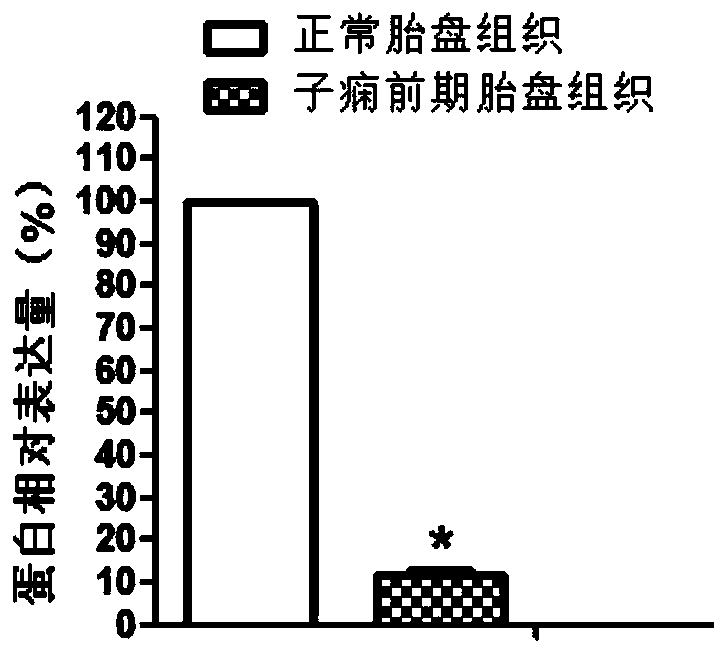 hcst gene as a target for diagnosis and treatment of preeclampsia