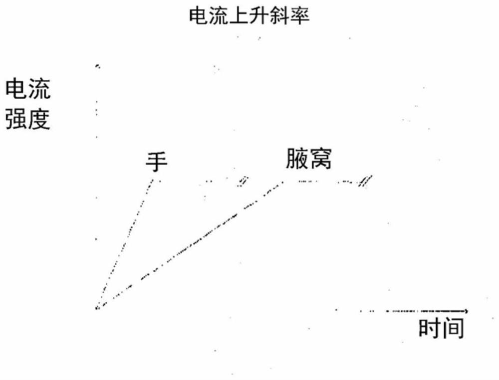 A system of method for treatment of hyperhidrosis by tap-water iontophoresis and electrotherapy using an improved electrode