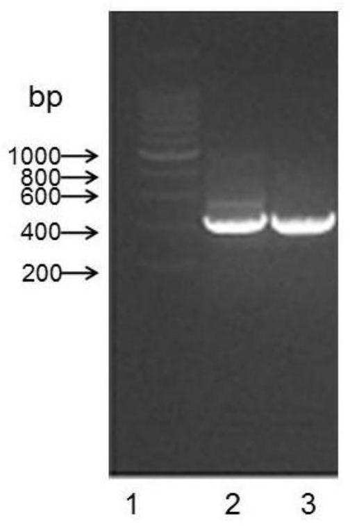 A kind of anti-human cd26 antibody and its application in detection kit