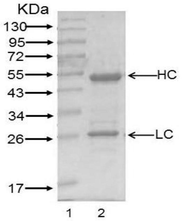 A kind of anti-human cd26 antibody and its application in detection kit