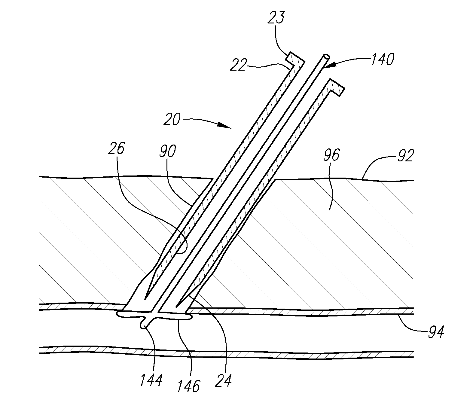 Apparatus and methods for sealing a vascular puncture