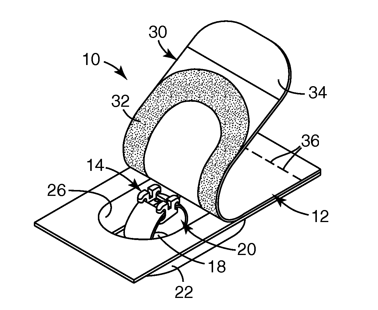 Packaged orthodontic appliance with user-applied adhesive