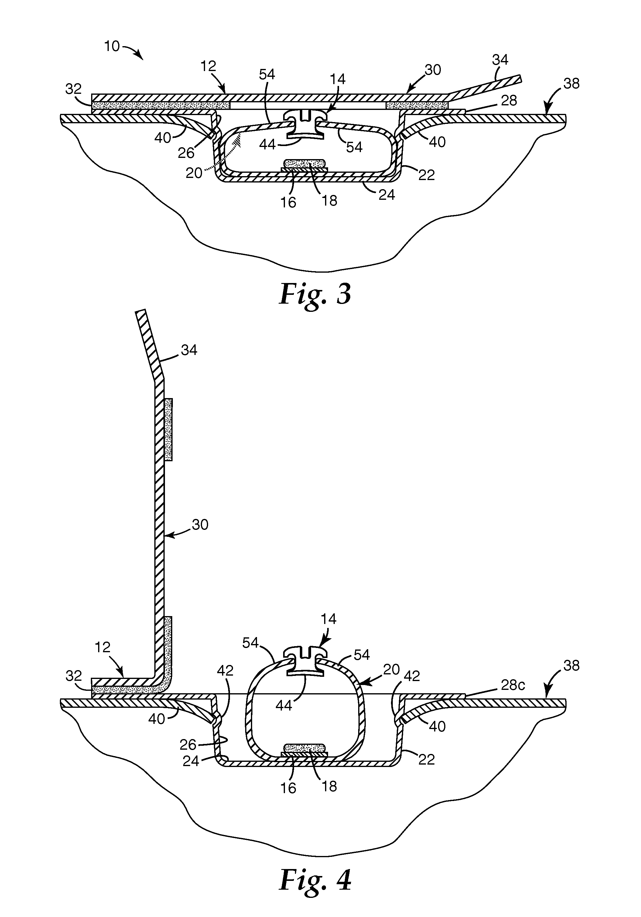 Packaged orthodontic appliance with user-applied adhesive