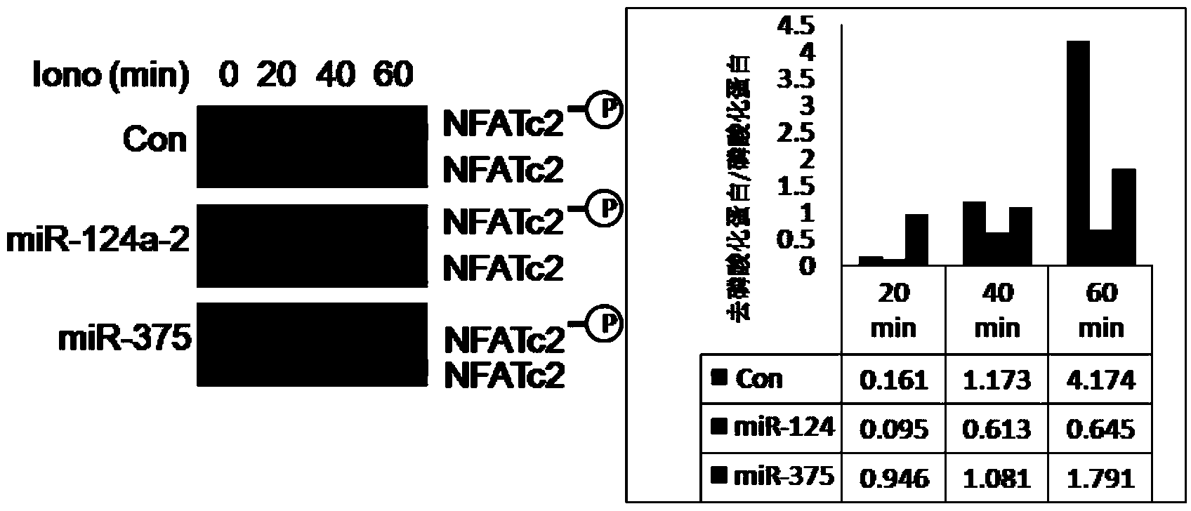 Application of micromolecule RNA used as immunosuppressor