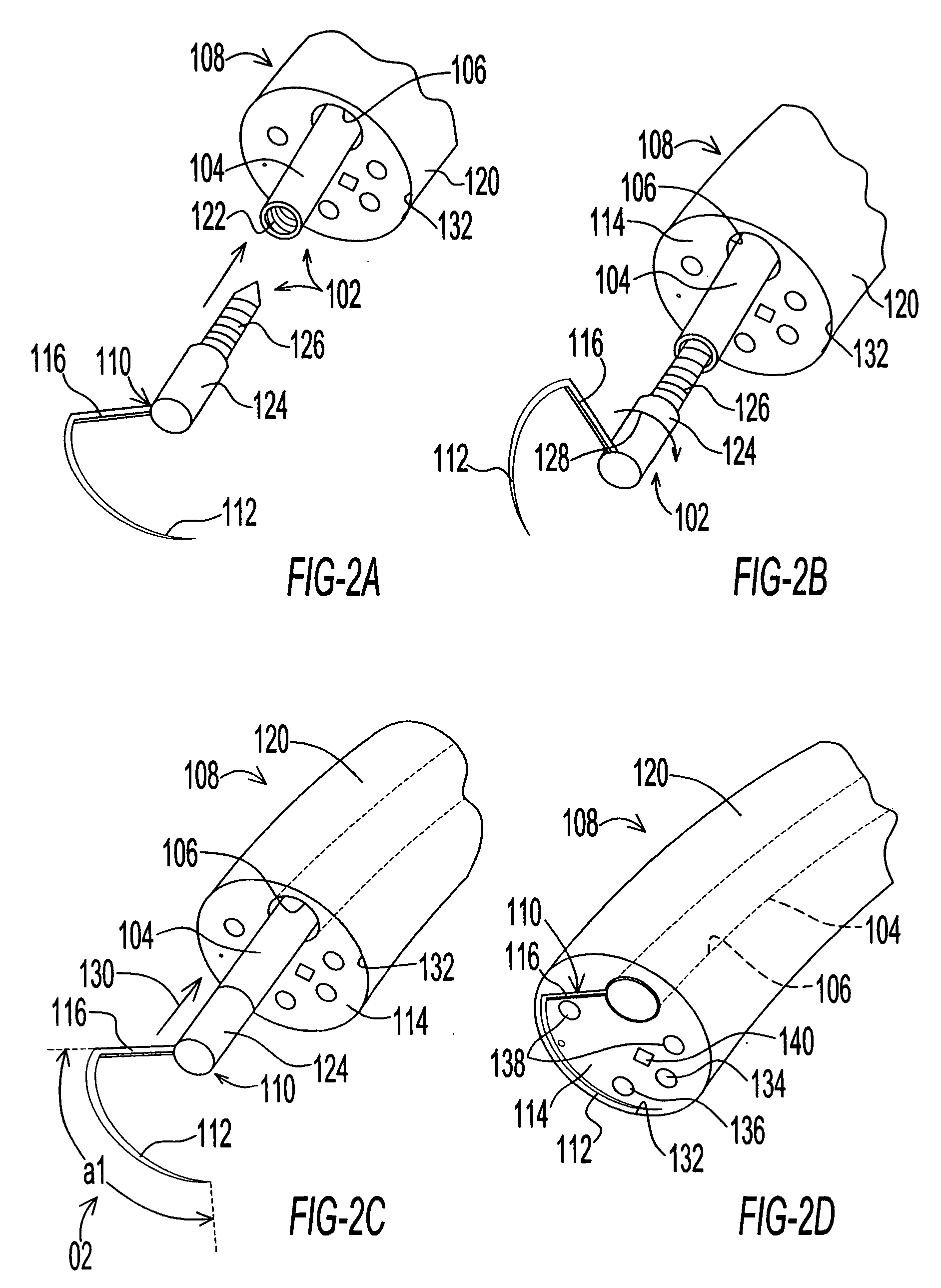 Endoscopic instrument assembly with separable operative tip and associated medical method