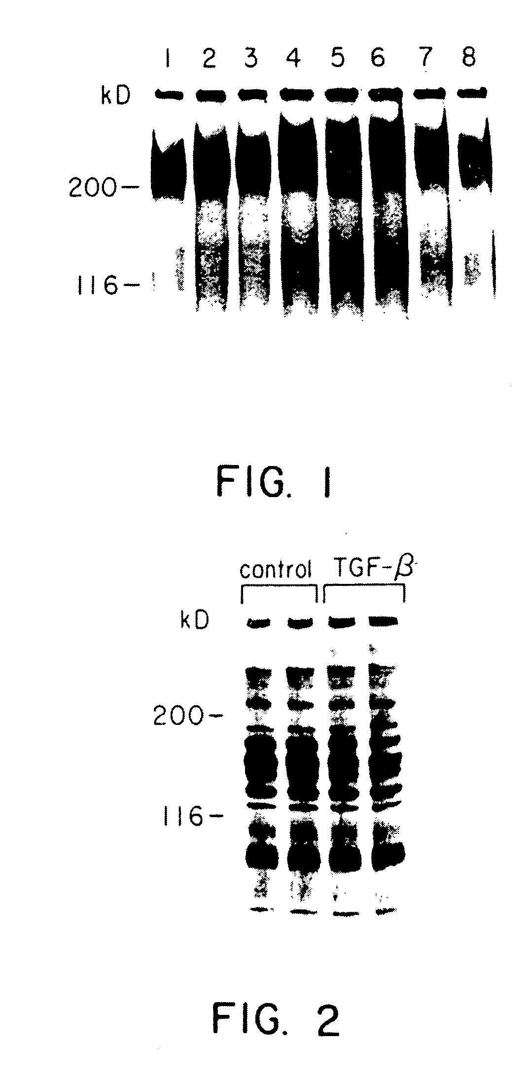 Inhibiting transforming growth factor beta to prevent accumulation of extracellular matrix