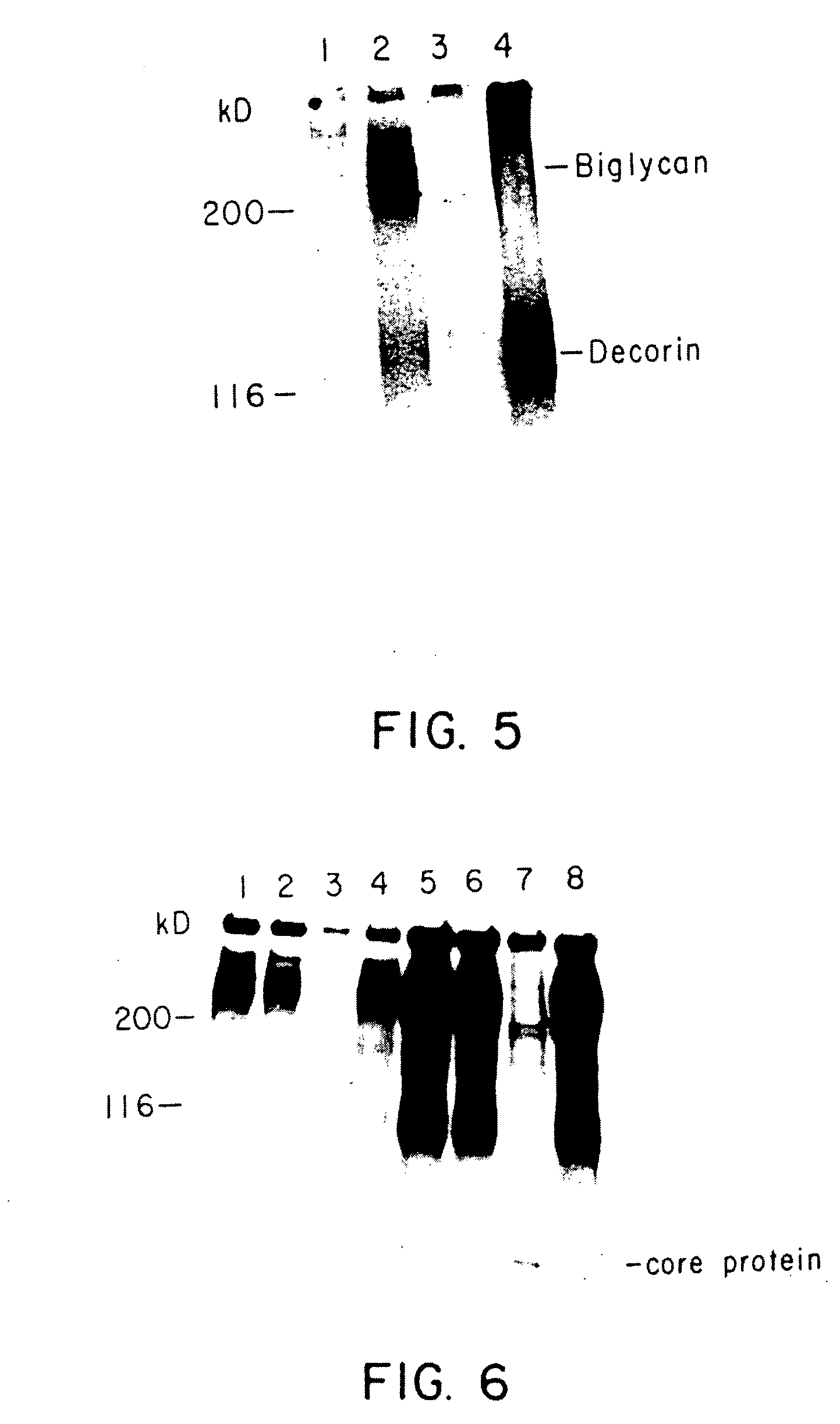 Inhibiting transforming growth factor beta to prevent accumulation of extracellular matrix