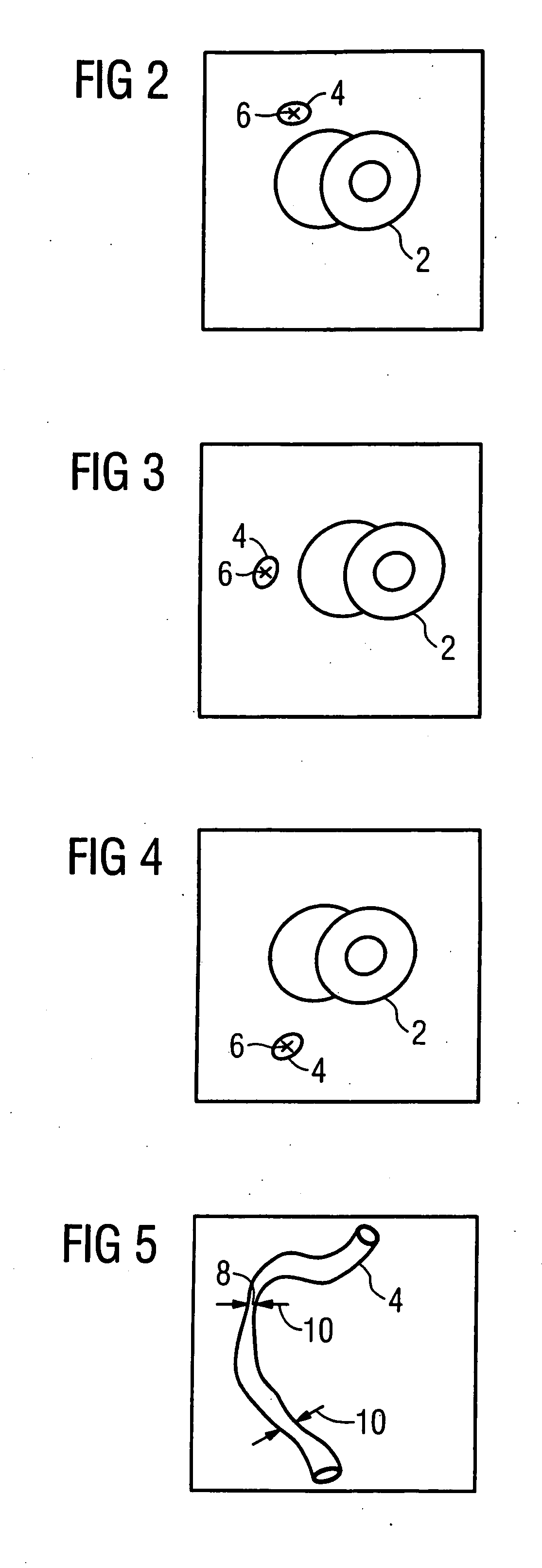 Method for segmenting a medical data set