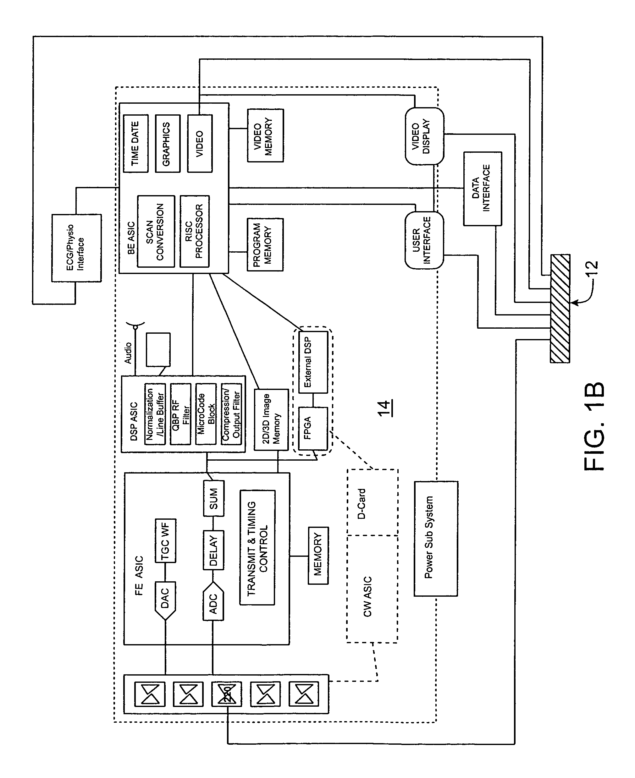 Modular apparatus for diagnostic ultrasound