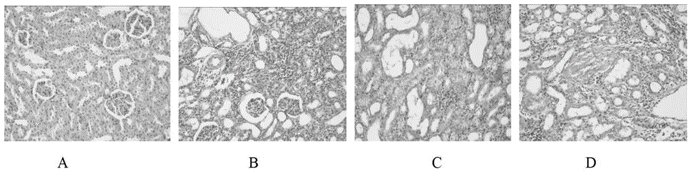 Bunge auriculate root extractive for preventing renal fibrosis