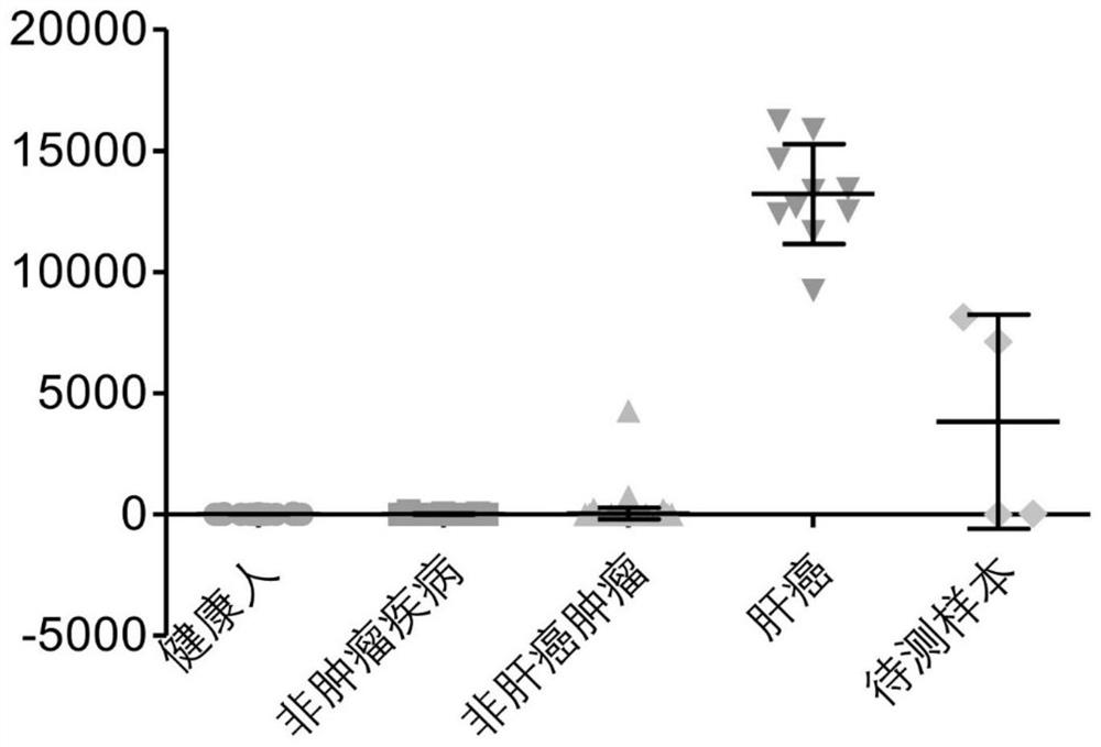 Peripheral blood TCR marker for liver cancer as well as detection kit and application thereof