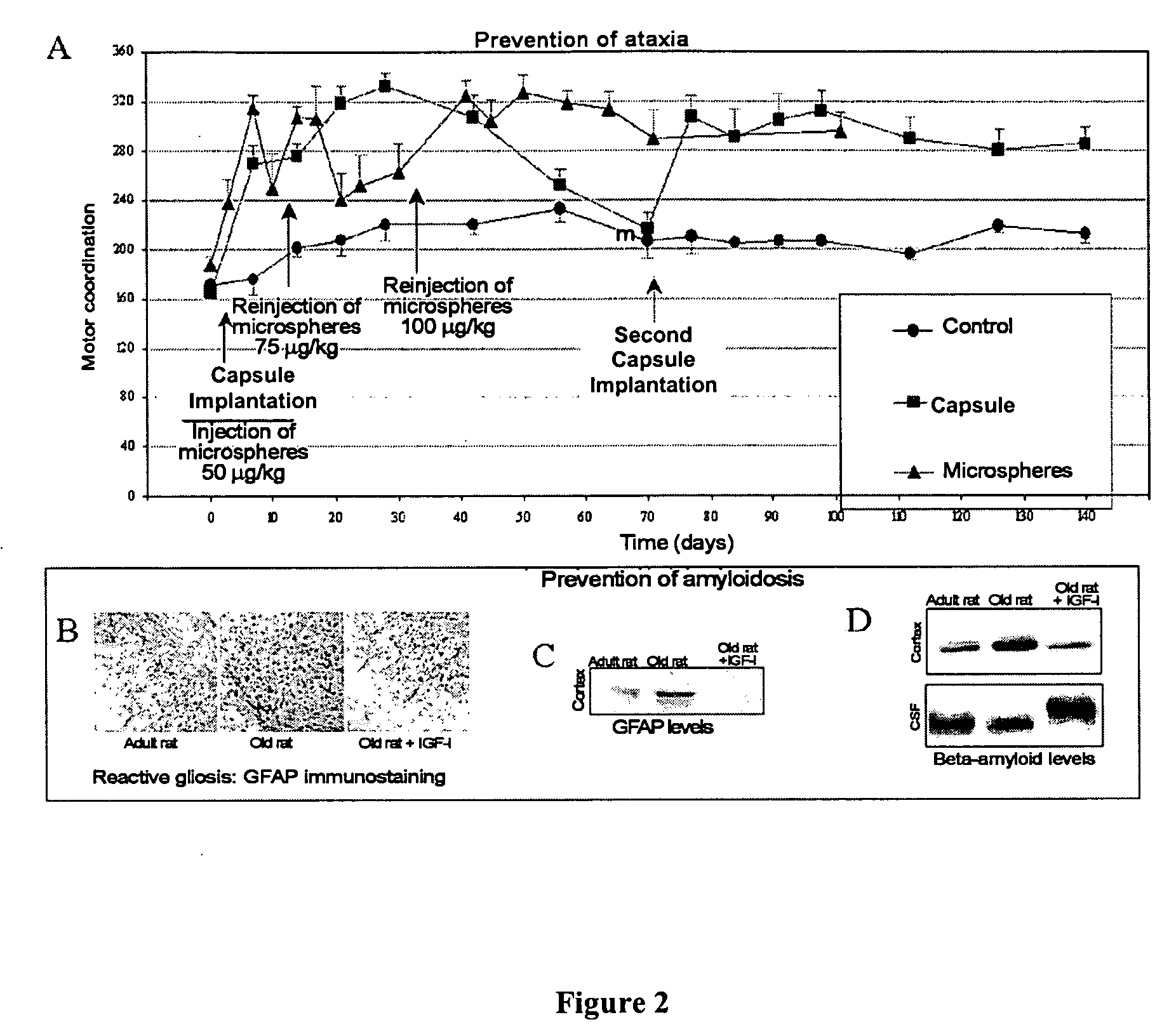 Chemical ifg-i composition for the treatment and prevention of neurodgenerative diseases