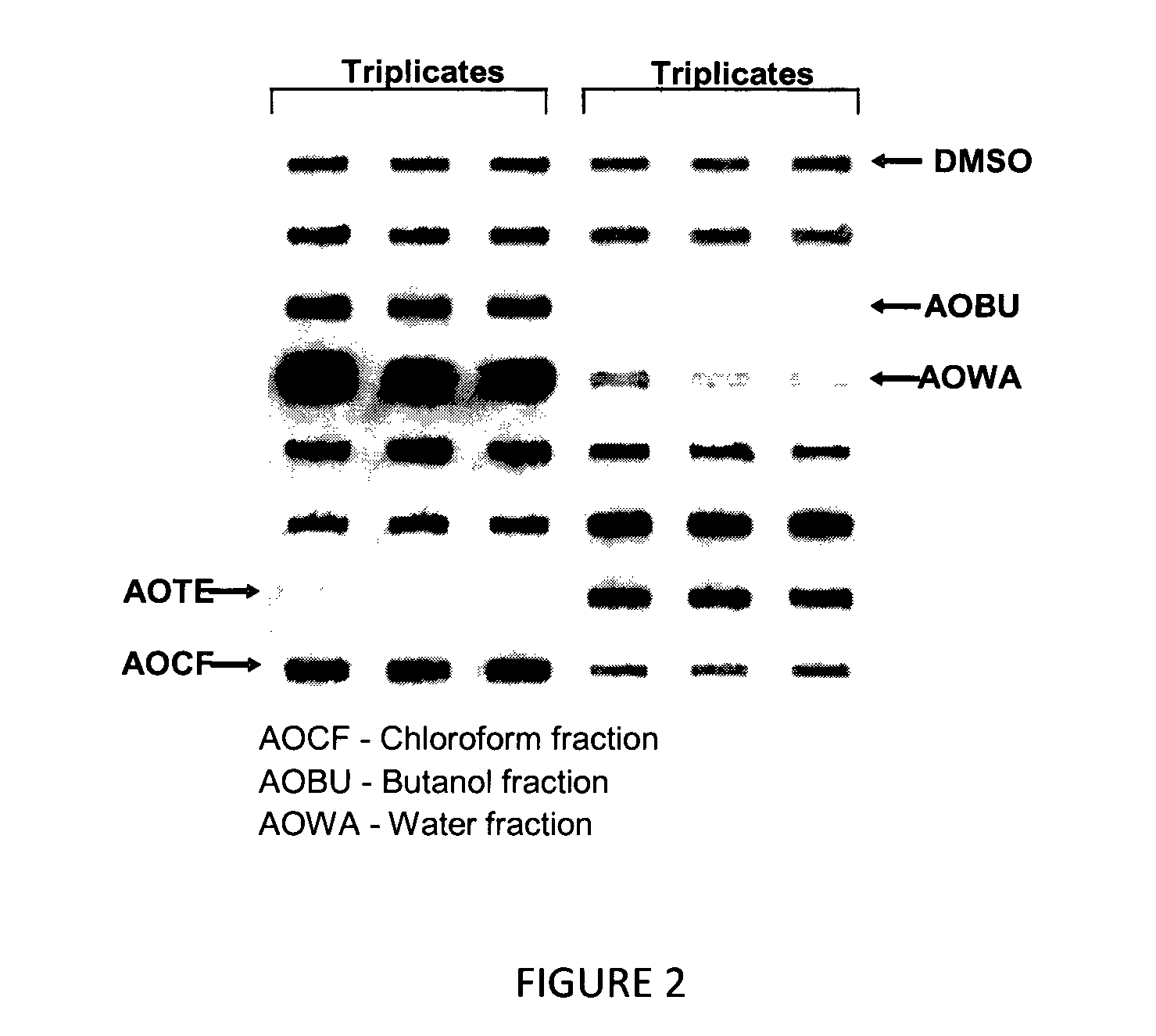 Composition for treating neurodegenerative disease or neuropathological condition