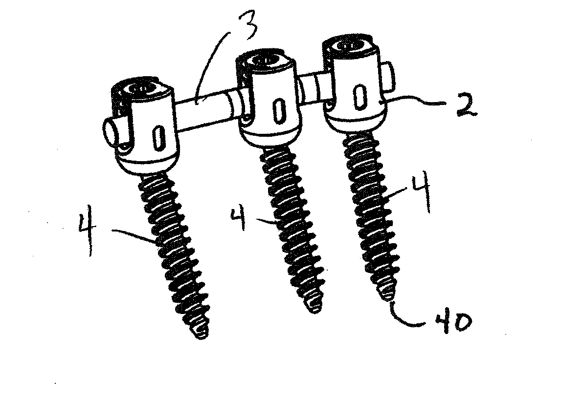 Polyaxial bone screw