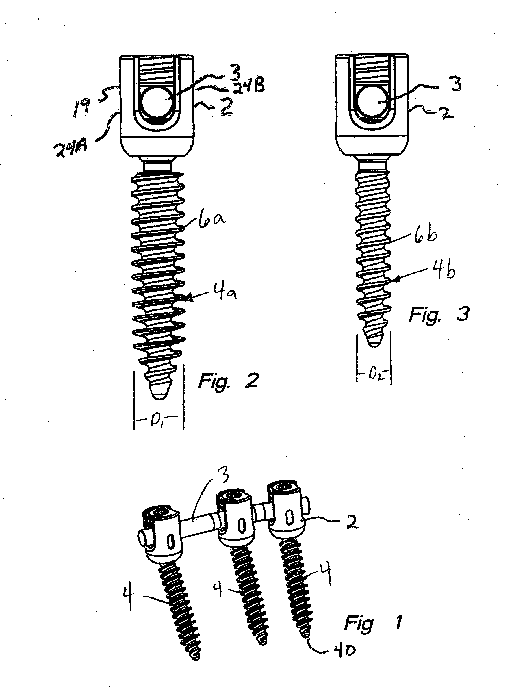 Polyaxial bone screw