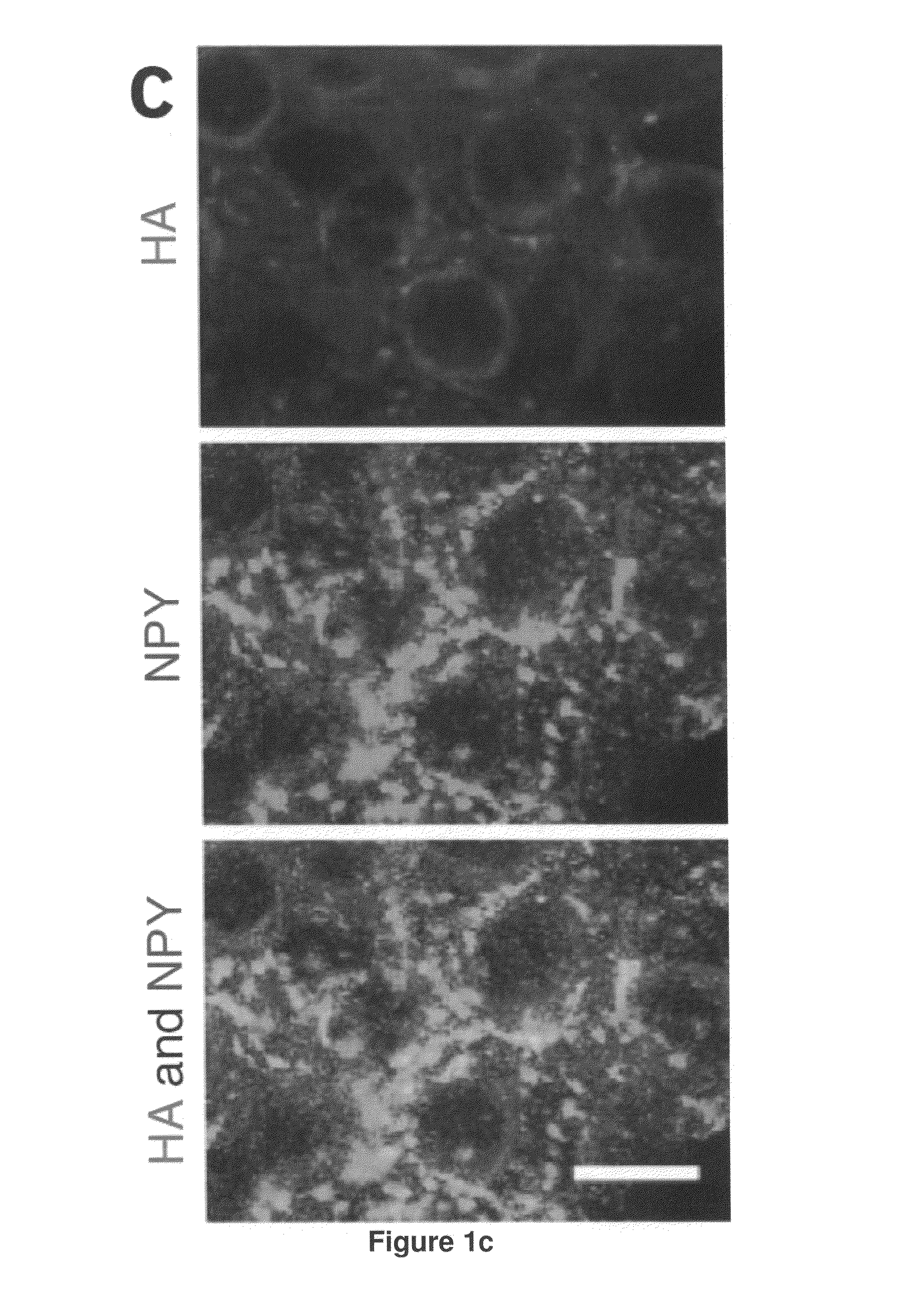 Treatment of metabolic-related disorders using hypothalamic gene transfer of BDNF and compositions therefor