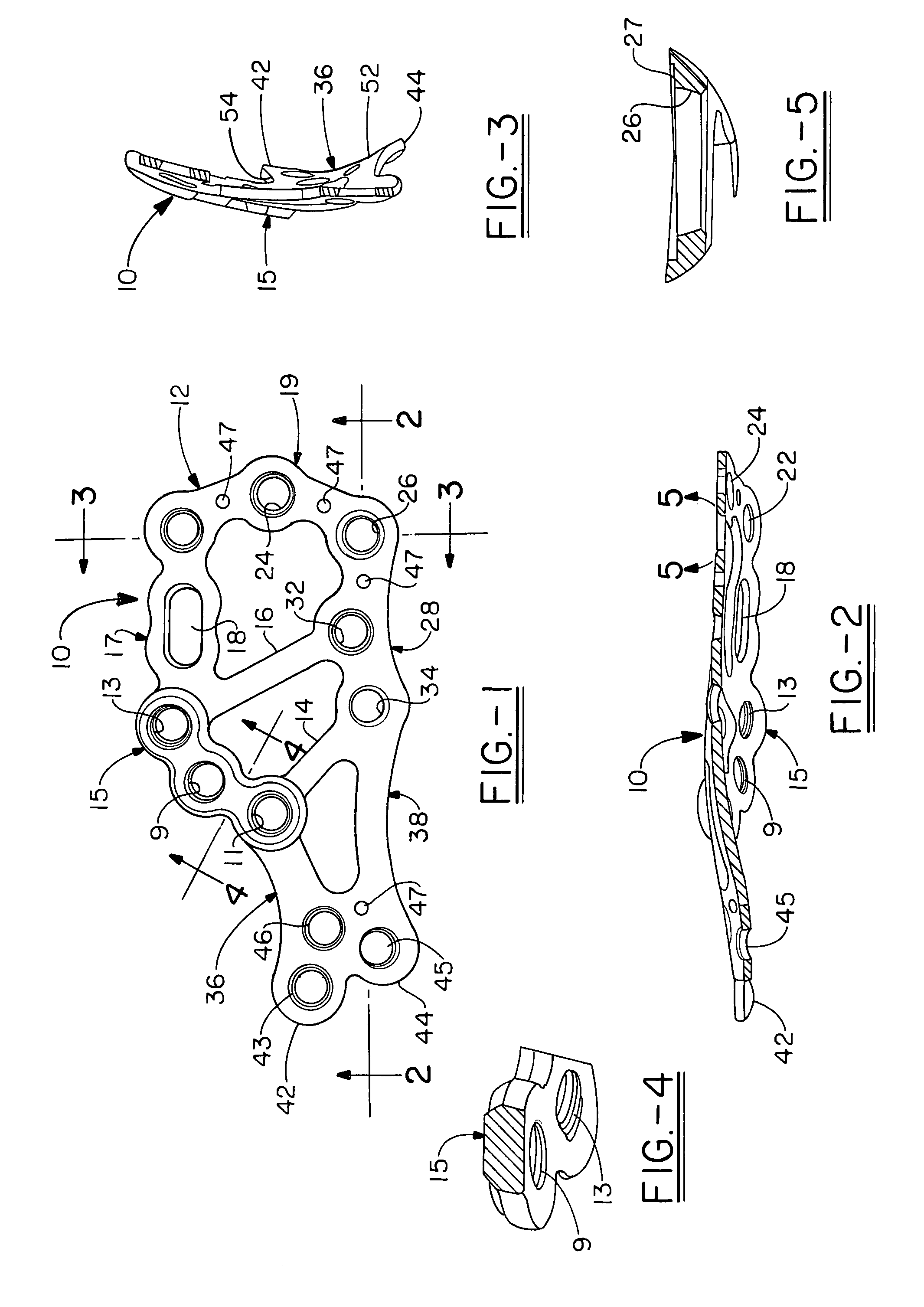 Calcaneal plate